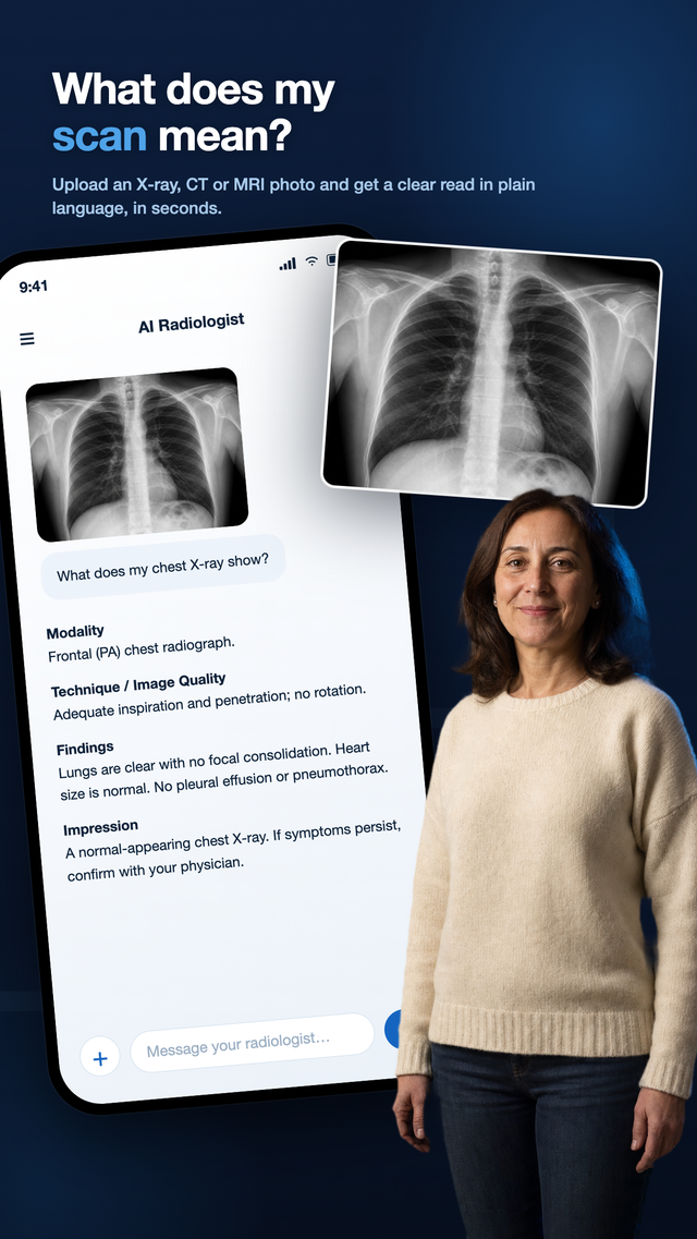 What does my scan mean: chest X-ray explained