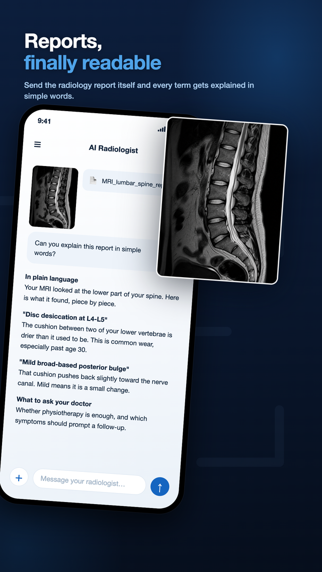 Radiology report explained in simple words